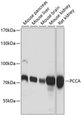Anti-PCCA antibody used in Western Blot (WB). GTX64505