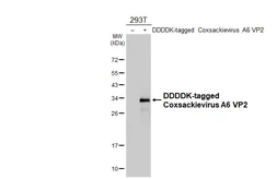 Anti-Coxsackievirus A6 VP2 antibody [HL4965] used in Western Blot (WB). GTX645051