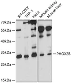 Anti-PHOX2B antibody used in Western Blot (WB). GTX64506