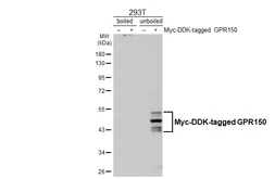 Anti-GPR150 antibody [HL4986] used in Western Blot (WB). GTX645072