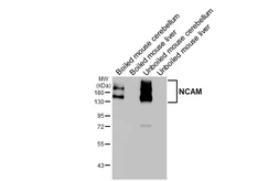 Anti-NCAM antibody [HL4992] used in Western Blot (WB). GTX645078