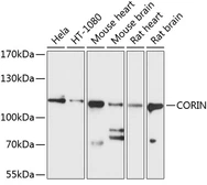Anti-CORIN antibody used in Western Blot (WB). GTX64508