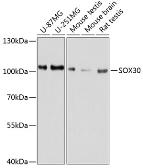 Anti-SOX30 antibody used in Western Blot (WB). GTX64509