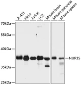Anti-Nup53 antibody used in Western Blot (WB). GTX64510
