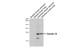 Anti-Claudin 18 antibody [HL5023] used in Western Blot (WB). GTX645116