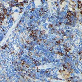 Anti-CYLD antibody used in IHC (Paraffin sections) (IHC-P). GTX64513