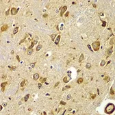 Anti-SMAD9 antibody used in IHC (Paraffin sections) (IHC-P). GTX64515
