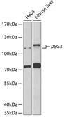 Anti-Desmoglein 3 antibody used in Western Blot (WB). GTX64516