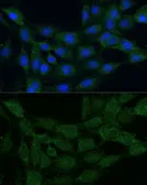 Anti-MTHFD2 antibody used in Immunocytochemistry/ Immunofluorescence (ICC/IF). GTX64519