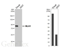 Anti-MLH1 antibody [HL5028] used in Western Blot (WB). GTX645198