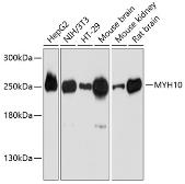 Anti-MYH10 antibody used in Western Blot (WB). GTX64520