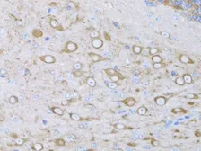 Anti-MYH10 antibody used in IHC (Paraffin sections) (IHC-P). GTX64520