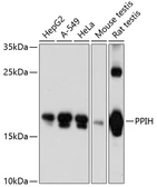 Anti-PPIH antibody used in Western Blot (WB). GTX64521