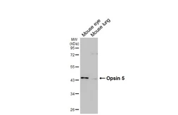 Anti-Opsin 5 antibody [HL5048] used in Western Blot (WB). GTX645218