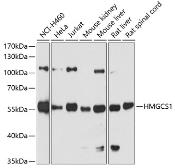 Anti-HMGCS1 antibody used in Western Blot (WB). GTX64522