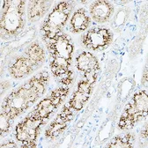 Anti-NEU1 antibody used in IHC (Paraffin sections) (IHC-P). GTX64524