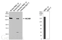 Anti-NCAM antibody [GT320] used in Western Blot (WB). GTX645244