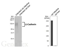Anti-LI-Cadherin antibody [GT329] used in Western Blot (WB). GTX645249