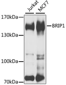 Anti-FANCJ antibody used in Western Blot (WB). GTX64525