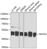 Anti-MAT2A antibody used in Western Blot (WB). GTX64527