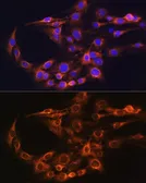 Anti-FCGRT antibody used in Immunocytochemistry/ Immunofluorescence (ICC/IF). GTX64528