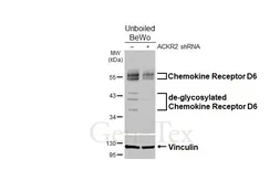 Anti-Chemokine Receptor D6 antibody [HL5104] used in Western Blot (WB). GTX645298