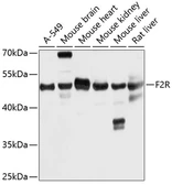 Anti-Thrombin Receptor antibody used in Western Blot (WB). GTX64534