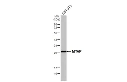 Anti-MTAP antibody [HL5147] used in Western Blot (WB). GTX645343