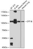 Anti-CPT1B antibody used in Western Blot (WB). GTX64535