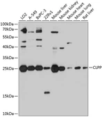 Anti-CLPP antibody used in Western Blot (WB). GTX64536