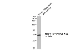 Anti-Yellow Fever virus NS3 protein antibody [GT341] used in Western Blot (WB). GTX645370