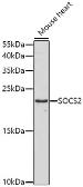 Anti-SOCS2 antibody used in Western Blot (WB). GTX64538