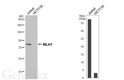 Anti-MLH1 antibody [HL5175] used in Western Blot (WB). GTX645427