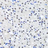 Anti-Livin antibody used in IHC (Paraffin sections) (IHC-P). GTX64543
