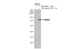 Anti-EGR1 antibody [HL5183] used in Western Blot (WB). GTX645435