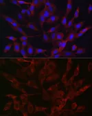 Anti-TMPRSS2 antibody used in Immunocytochemistry/ Immunofluorescence (ICC/IF). GTX64544