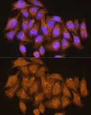 Anti-ATP6V1E1 antibody used in Immunocytochemistry/ Immunofluorescence (ICC/IF). GTX64545