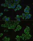Anti-ECHS1 antibody used in Immunocytochemistry/ Immunofluorescence (ICC/IF). GTX64546
