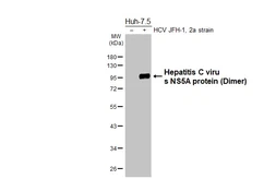 Anti-Hepatitis C virus NS5A protein antibody [HL5214] used in Western Blot (WB). GTX645470