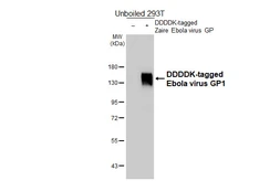 Anti-Ebola virus GP1 antibody [HL5217] used in Western Blot (WB). GTX645473