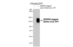 Anti-Ebola virus GP1 antibody [HL5221] used in Western Blot (WB). GTX645477