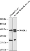Anti-Interferon gamma Receptor 2 antibody used in Western Blot (WB). GTX64548