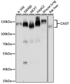 Anti-Calpastatin antibody used in Western Blot (WB). GTX64549
