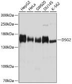 Anti-Desmoglein 2 antibody used in Western Blot (WB). GTX64551