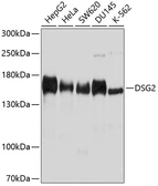 Anti-Desmoglein 2 antibody used in Western Blot (WB). GTX64551