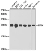 Anti-EIF3K antibody used in Western Blot (WB). GTX64552
