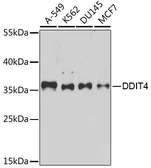 Anti-REDD1 antibody used in Western Blot (WB). GTX64553