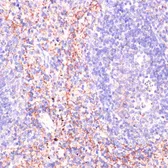 Anti-RAP1A antibody used in IHC (Paraffin sections) (IHC-P). GTX64554