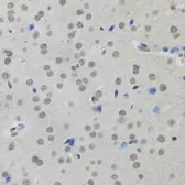 Anti-MKL1 antibody used in IHC (Paraffin sections) (IHC-P). GTX64556