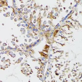 Anti-Galactosylceramidase antibody used in IHC (Paraffin sections) (IHC-P). GTX64559